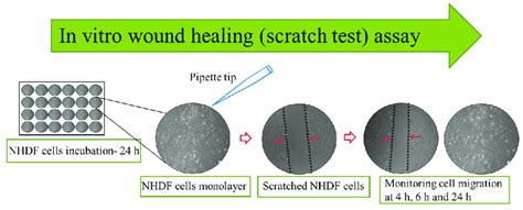 scratch test wound healing|scratch assay images.